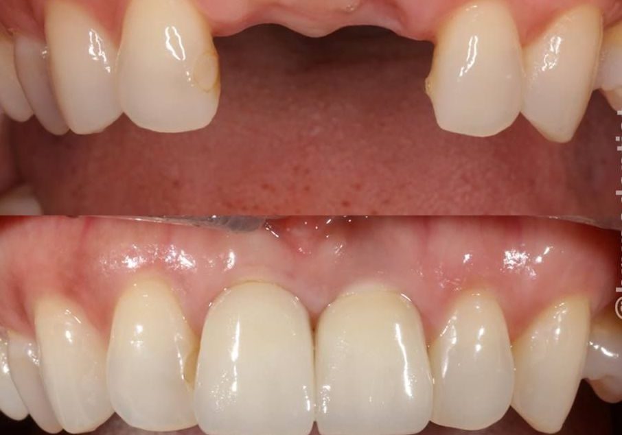 1 Before And And After Copy Landscape