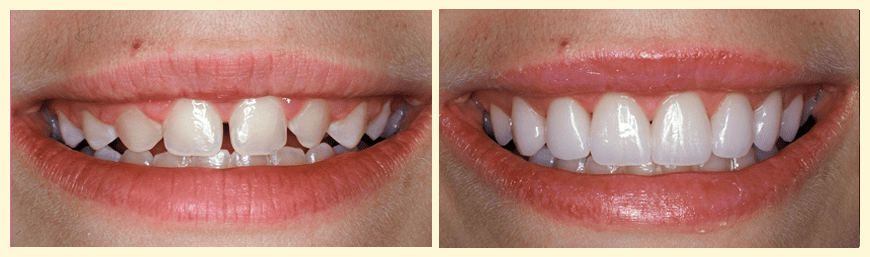 Eternal Smiles Dental Centre