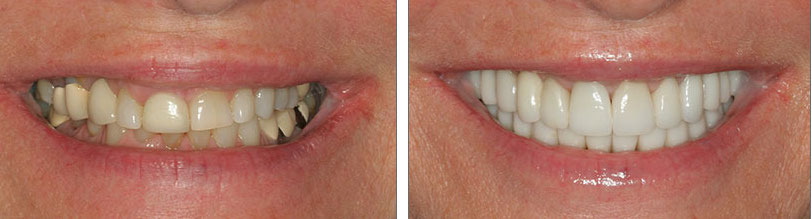 Eternal Smiles Dental Centre