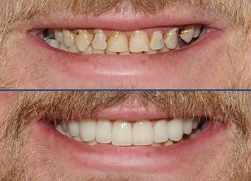 Eternal Smiles Dental Centre