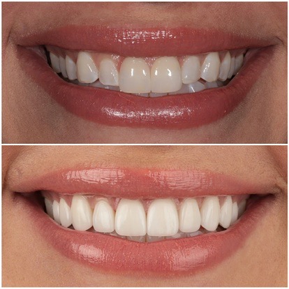 Eternal Smiles Dental Centre
