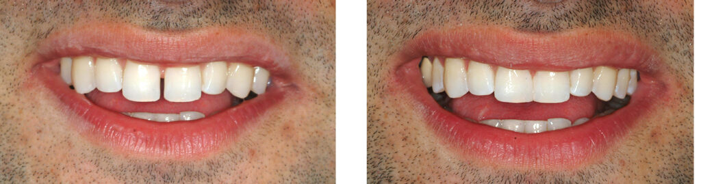 Eternal Smiles Dental Centre