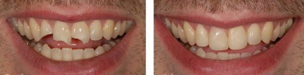 Eternal Smiles Dental Centre