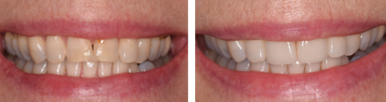 Eternal Smiles Dental Centre