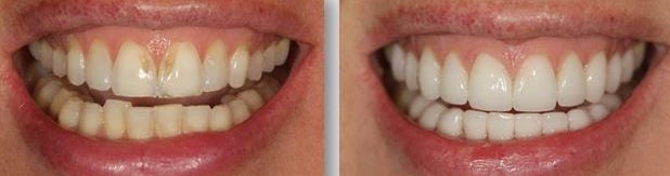 Eternal Smiles Dental Centre
