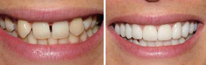 Eternal Smiles Dental Centre