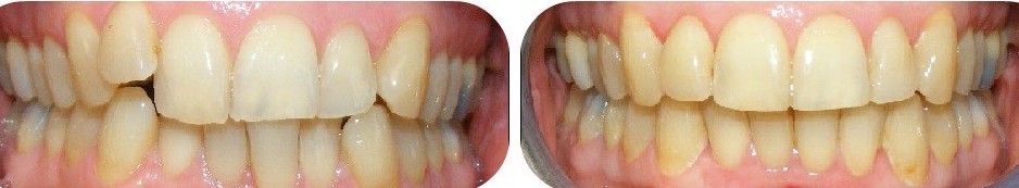 Eternal Smiles Dental Centre