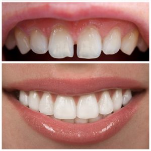 Eternal Smiles Dental Centre