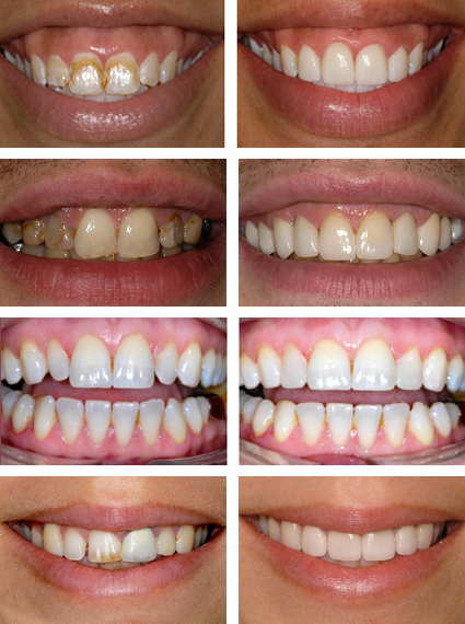 Eternal Smiles Dental Centre