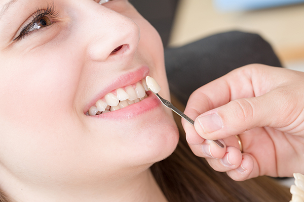 Smile Makeovers + Dental Makeover + Teeth Makeover