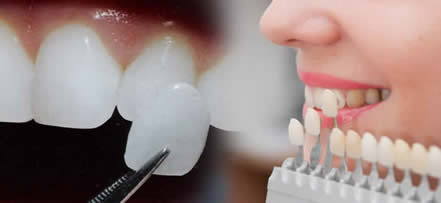 Eternal Smiles Dental Centre
