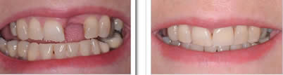 Eternal Smiles Dental Centre