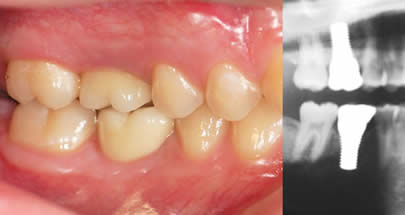 Eternal Smiles Dental Centre