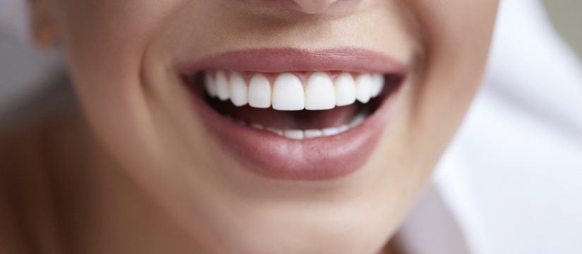 Want A Smile With Dental Veneers. 5 Important Things