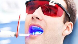 Cold Sores And Ulcers